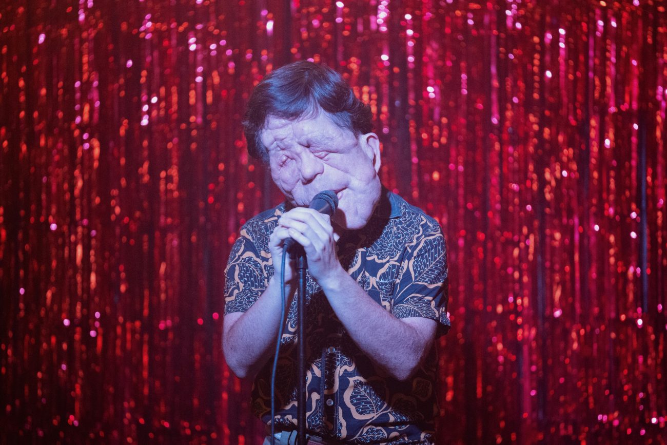 A Different Man – Adam Pearson – Photo Credit Matt Infante – Courtesy of A24 – © A24 – Immagine concessa da A24 per uso stampa
